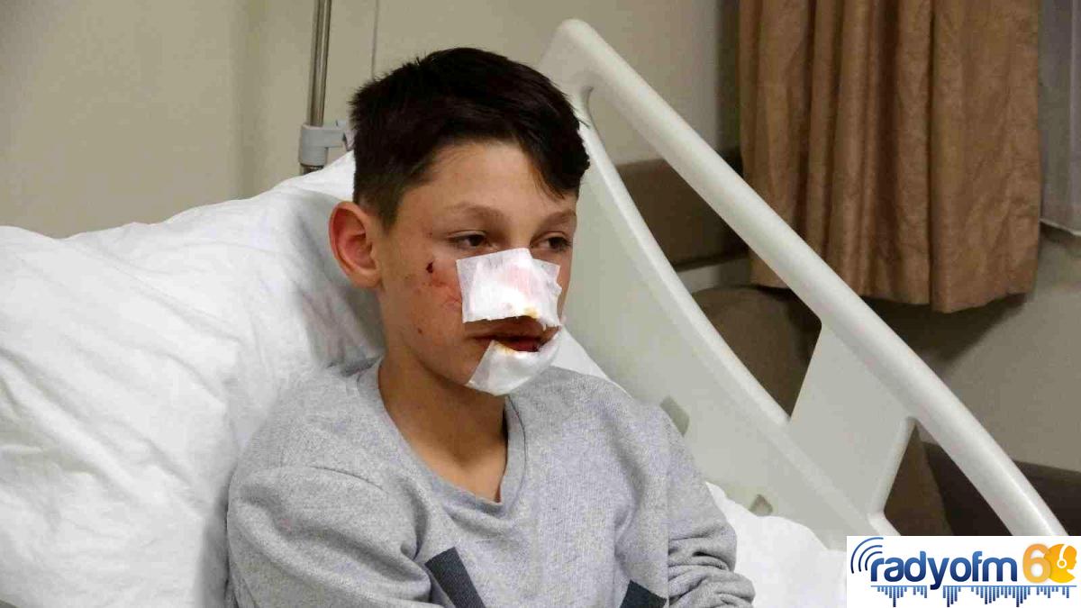 Köpek saldırısına uğrayan çocuk yüz bölgesinden yaralandı